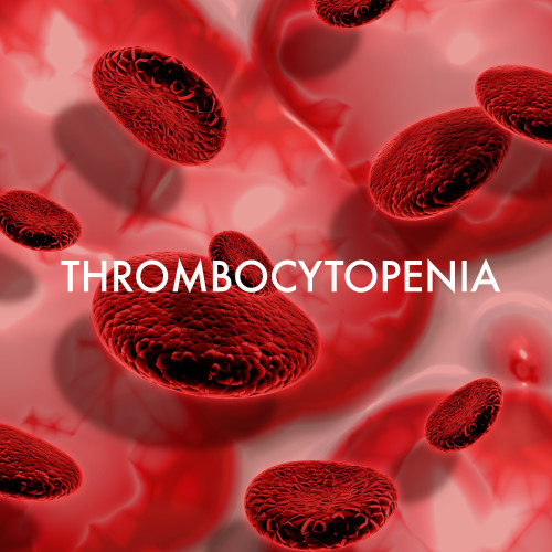 Thrombocytopenia